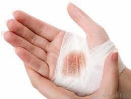 Home remedies for general wounds