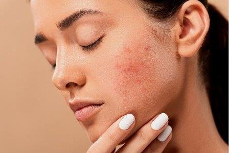 Skin Health Secrets!