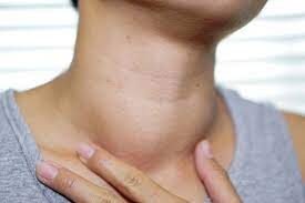 Thyroid in Males - thyroid test