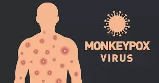 monkeypox virus