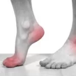 Foot Problems and Remedies