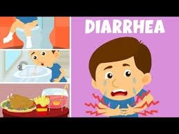 Diarrhea