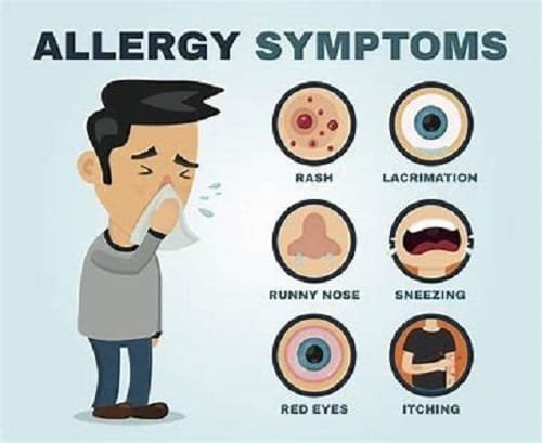 allergy symptoms