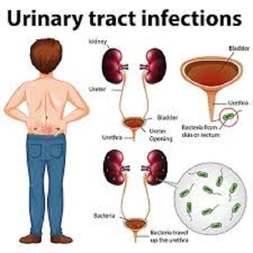 urine infection symptom