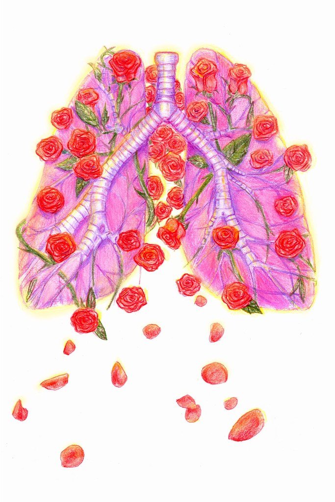 65 roses disease - cystic fibrosis